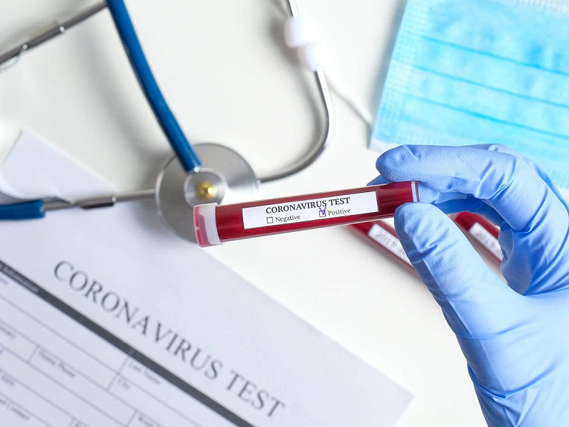 Coronavirus Test Nepal